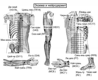 Акупунктурные точки при экземе