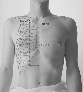 R27 Шу-фу (KID 27)