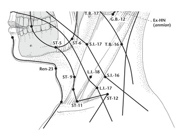 VC22 Тянь-ту (REN 22)